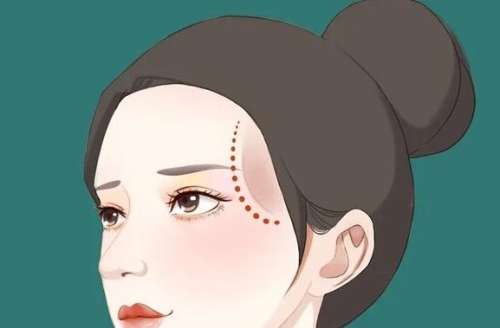 太阳穴填充03.jpg 太阳穴填充03.jpg