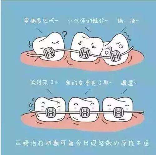 u=3863592541,3911877277&fm=26&gp=0.jpg