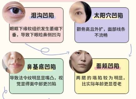 鼻基底 鼻基底