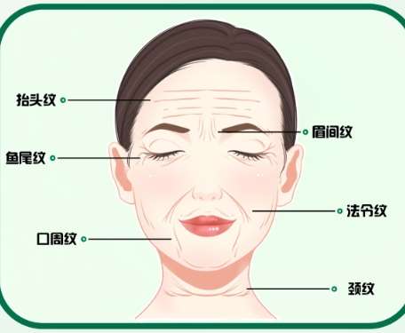 除皱 除皱