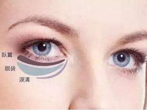 眼袋1.jpg